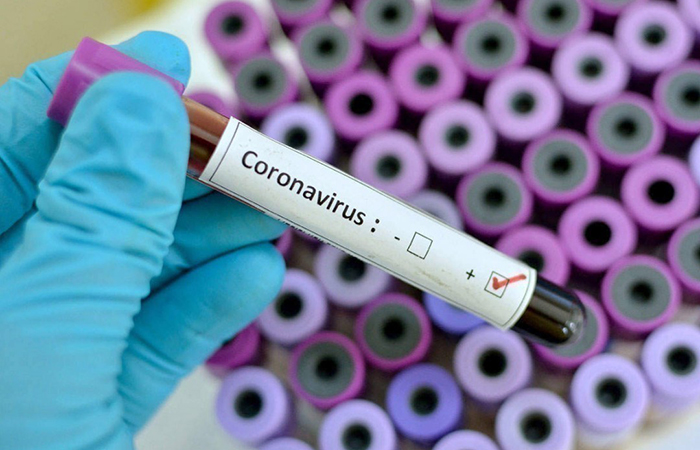 picture2 koronavirus epide 366087 p0 L